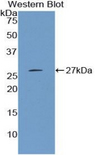 CTH / Cystathionase Antibody - Western blot of recombinant CTH.  This image was taken for the unconjugated form of this product. Other forms have not been tested.