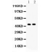 CTH / Cystathionase Antibody - Cystathionase antibody Western blot. All lanes: Anti Cystathionase at 0.5 ug/ml. Lane 1: Rat Liver Tissue Lysate at 50 ug. Lane 2: Mouse Liver Tissue Lysate at 50 ug. Predicted band size: 45 kD. Observed band size: 45 kD.