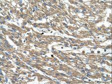 CTH / Cystathionase Antibody - CTH antibody CTH(cystathionase (cystathionine gamma-lyase)) Antibody was used in IHC to stain formalin-fixed, paraffin-embedded human heart.  This image was taken for the unconjugated form of this product. Other forms have not been tested.