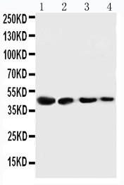 CTH / Cystathionase Antibody - WB of CTH antibody. All lanes: Anti-CTH at 0.5ug/ml. Lane 1: SMMC Whole Cell Lysate at 40ug. Lane 2: HT180 Whole Cell Lysate at 40ug. Lane 3: HELA Whole Cell Lysate at 40ug. Lane 4: U87 Whole Cell Lysate at 40ug. Predicted bind size: 44KD. Observed bind size: 44KD.