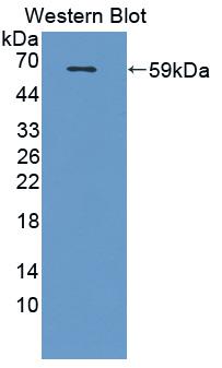 CTH / Cystathionase Antibody - Western blot of CTH antibody.