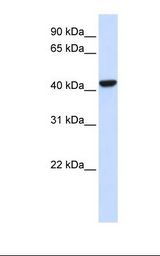 CTH / Cystathionase Antibody - Transfected 293T cell lysate. Antibody concentration: 1.0 ug/ml. Gel concentration: 12%.  This image was taken for the unconjugated form of this product. Other forms have not been tested.
