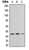 CTH / Cystathionase Antibody - Western blot analysis of CTH expression in HEK293T (A); Raw264.7 (B); PC12 (C) whole cell lysates.