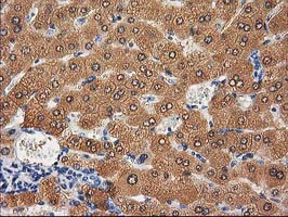 CTH / Cystathionase Antibody - IHC of paraffin-embedded Human liver tissue using anti-CTH mouse monoclonal antibody. (Heat-induced epitope retrieval by 10mM citric buffer, pH6.0, 100C for 10min).