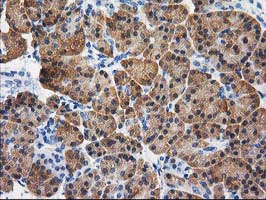 CTH / Cystathionase Antibody - IHC of paraffin-embedded Human pancreas tissue using anti-CTH mouse monoclonal antibody. (Heat-induced epitope retrieval by 10mM citric buffer, pH6.0, 100C for 10min).