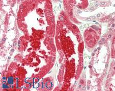 CTH / Cystathionase Antibody - Human Kidney: Formalin-Fixed, Paraffin-Embedded (FFPE)