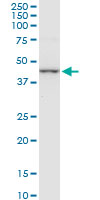 CTH / Cystathionase Antibody - CTH monoclonal antibody (M01), clone 4E1-1B7. Western blot of CTH expression in HeLa NE.