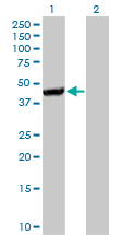 CTH / Cystathionase Antibody - Western blot of CTH expression in transfected 293T cell line by CTH monoclonal antibody (M01), clone 4E1-1B7.