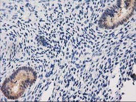 CTH / Cystathionase Antibody - IHC of paraffin-embedded Human endometrium tissue using anti-CTH mouse monoclonal antibody. (Heat-induced epitope retrieval by 10mM citric buffer, pH6.0, 100C for 10min).