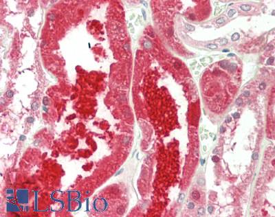 CTH / Cystathionase Antibody - Human Kidney: Formalin-Fixed, Paraffin-Embedded (FFPE)