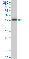 CTH / Cystathionase Antibody - CTH monoclonal antibody (M03), clone S51 Western blot of CTH expression in K-562.