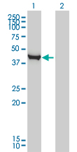 CTH / Cystathionase Antibody - Western blot of CTH expression in transfected 293T cell line by CTH monoclonal antibody (M03), clone S51.