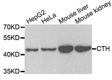 CTH / Cystathionase Antibody - Western blot analysis of extracts of various cell lines, using CTH antibody.