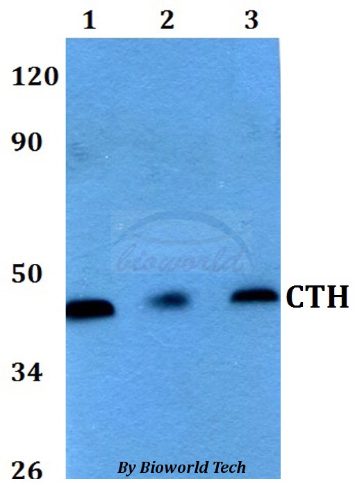 CTH / Cystathionase Antibody - Western blot of CTH antibody at 1:500 dilution. Lane 1: HEK293T whole cell lysate. Lane 2: Raw264.7 whole cell lysate. Lane 3: PC12 whole cell lysate.