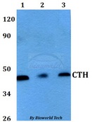 CTH / Cystathionase Antibody - Western blot of CTH antibody at 1:500 dilution. Lane 1: HEK293T whole cell lysate. Lane 2: Raw264.7 whole cell lysate. Lane 3: PC12 whole cell lysate.