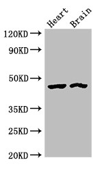 CTH / Cystathionase Antibody - Positive WB detected in:Rat heart tissue,Mouse brain tissue;All lanes:CTH antibody at 4?g/ml;Secondary;Goat polyclonal to rabbit IgG at 1/50000 dilution;Predicted band size: 45,40,42 KDa;Observed band size: 45 KDa;