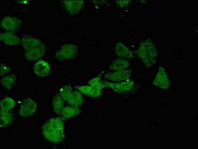 CTH / Cystathionase Antibody - Immunofluorescent analysis of HepG2 cells using CTH Antibody at dilution of 1:100 and Alexa Fluor 488-congugated AffiniPure Goat Anti-Rabbit IgG(H+L)