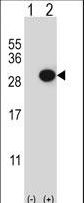 CTHRC1 Antibody - Western blot of CTHRC1 (arrow) using rabbit polyclonal CTHRC1 Antibody. 293 cell lysates (2 ug/lane) either nontransfected (Lane 1) or transiently transfected (Lane 2) with the CTHRC1 gene.