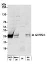 CTHRC1 Antibody - Detection of human and mouse CTHRC1 by western blot. Samples: Whole cell lysate (50 µg) from UACC-62, Malme-3M, SR, and NIH 3T3 cells prepared using NETN lysis buffer. Antibody: Affinity purified Rabbit anti-CTHRC1 antibody used for WB at 1:1000. Detection: Chemiluminescence with an exposure time of 10 seconds.