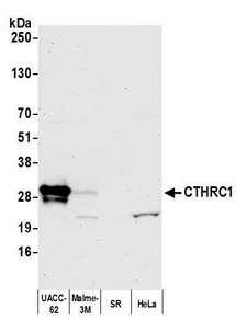 CTHRC1 Antibody - Detection of human CTHRC1 by western blot. Samples: Whole cell lysate (50 µg) from UACC-62, Malme-3M, SR, and HeLa cells prepared using NETN lysis buffer. Antibody: Affinity purified Rabbit anti-CTHRC1 antibody used for WB at 1:1000. Secondary: HRP-conjugated goat anti-rabbit IgG (A120-101P). Chemiluminescence with an exposure time of 10 seconds.