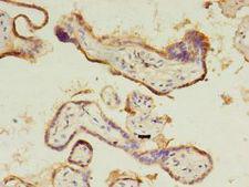 CTHRC1 Antibody - Immunohistochemistry of paraffin-embedded human placenta tissue using antibody at 1:100 dilution.  This image was taken for the unconjugated form of this product. Other forms have not been tested.