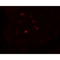 CTHRC1 Antibody - Immunofluorescence of CTHRC1 in human small intestine tissue with CTHRC1 antibody at 20 µg/mL.