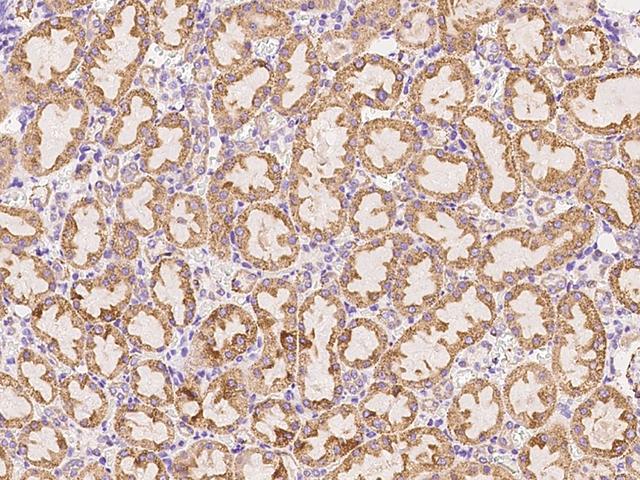 CTHRC1 Antibody - Immunochemical staining of rat CTHRC1 in rat kidney with rabbit polyclonal antibody at 1:200 dilution, formalin-fixed paraffin embedded sections.