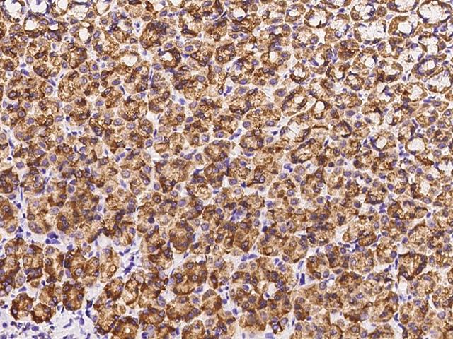 CTHRC1 Antibody - Immunochemical staining of rat CTHRC1 in rat stomach with rabbit polyclonal antibody at 1:200 dilution, formalin-fixed paraffin embedded sections.