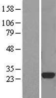 CTHRC1 Protein - Western validation with an anti-DDK antibody * L: Control HEK293 lysate R: Over-expression lysate