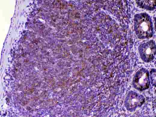 CTLA4 / CD152 Antibody - IHC analysis of CTLA4 using anti-CTLA4 antibody. CTLA4 was detected in paraffin-embedded section of rat lymphaden tissue. Heat mediated antigen retrieval was performed in citrate buffer (pH6, epitope retrieval solution) for 20 mins. The tissue section was blocked with 10% goat serum. The tissue section was then incubated with 1µg/ml rabbit anti-CTLA4 Antibody overnight at 4°C. Biotinylated goat anti-rabbit IgG was used as secondary antibody and incubated for 30 minutes at 37°C. The tissue section was developed using Strepavidin-Biotin-Complex (SABC) with DAB as the chromogen.