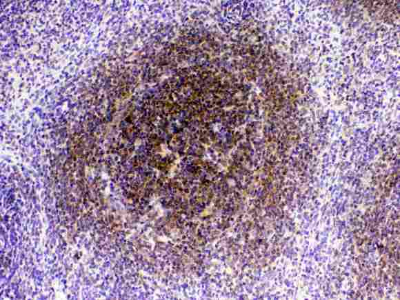 CTLA4 / CD152 Antibody - IHC analysis of CTLA4 using anti-CTLA4 antibody. CTLA4 was detected in paraffin-embedded section of rat spleen tissue . Heat mediated antigen retrieval was performed in citrate buffer (pH6, epitope retrieval solution) for 20 mins. The tissue section was blocked with 10% goat serum. The tissue section was then incubated with 1µg/ml rabbit anti-CTLA4 Antibody overnight at 4°C. Biotinylated goat anti-rabbit IgG was used as secondary antibody and incubated for 30 minutes at 37°C. The tissue section was developed using Strepavidin-Biotin-Complex (SABC) with DAB as the chromogen.