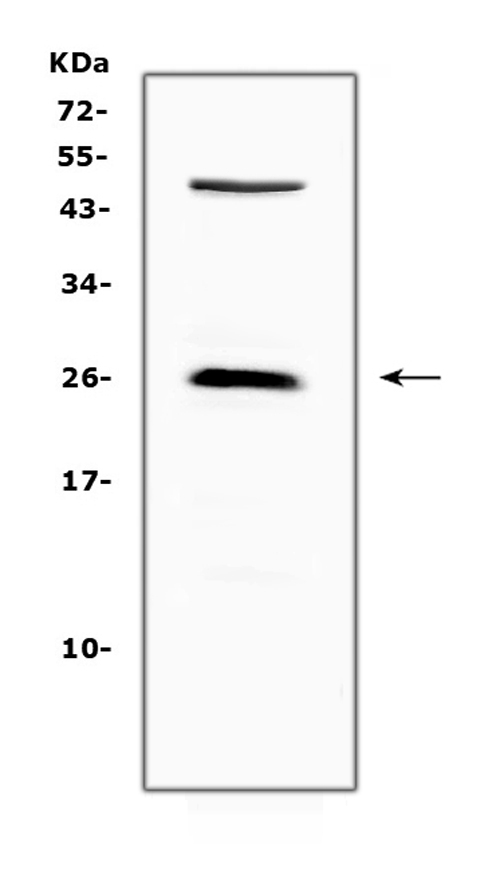 CTLA4 / CD152 Antibody - Western blot analysis of CTLA4 using anti-CTLA4 antibody. Electrophoresis was performed on a 5-20% SDS-PAGE gel at 70V (Stacking gel) / 90V (Resolving gel) for 2-3 hours. The sample well of each lane was loaded with 50ug of sample under reducing conditions. Lane 1: mouse NIH3T3 whole Cell lysate. After Electrophoresis, proteins were transferred to a Nitrocellulose membrane at 150mA for 50-90 minutes. Blocked the membrane with 5% Non-fat Milk/ TBS for 1.5 hour at RT. The membrane was incubated with rabbit anti-CTLA4 antigen affinity purified polyclonal antibody at 0.5 µg/mL overnight at 4°C, then washed with TBS-0.1% Tween 3 times with 5 minutes each and probed with a goat anti-rabbit IgG-HRP secondary antibody at a dilution of 1:10000 for 1.5 hour at RT. The signal is developed using an Enhanced Chemiluminescent detection (ECL) kit with Tanon 5200 system. A specific band was detected for CTLA4 at approximately 25KD. The expected band size for CTLA4 is at 25KD.
