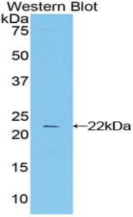 CTLA4 / CD152 Antibody - Western blot of recombinant CTLA4 / CD152.  This image was taken for the unconjugated form of this product. Other forms have not been tested.