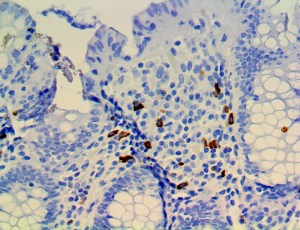 CTLA4 / CD152 Antibody - IHC of CTLA-4 on an FFPE Colon Tissue