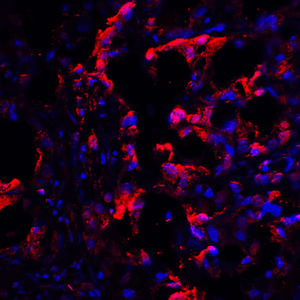 CTLA4 / CD152 Antibody - Immunofluorescence of CTLA-4 in human lymph node tissue with CTLA-4 antibody at 20 ug/mL. Red: CTLA4 Antibody [1E6] Blue: DAPI staining