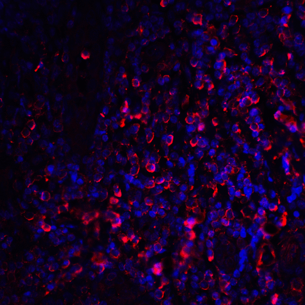CTLA4 / CD152 Antibody - Immunofluorescence of CTLA-4 in human tonsil tissue with CTLA-4 antibody at 20 ug/mL. Red: CTLA4 Antibody [1E6] Blue: DAPI staining