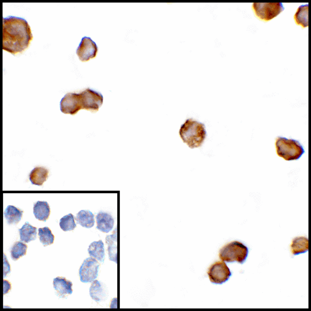 CTLA4 / CD152 Antibody - Immunocytochemistry of CTLA-4 in transfected HEK293 cells with CTLA-4 antibody at 5 ug/mL. Lower left: Immunocytochemistry in transfected HEK293 cells with control mouse IgG antibody at 5 ug/mL.
