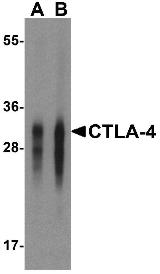 CTLA4 / CD152 Antibody - Western blot analysis of CTLA-4 in overexpressing HEK293 cells CTLA-4 antibody at 0.125 and 0.25 ug/mL.