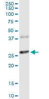CTLA4 / CD152 Antibody - CTLA4 monoclonal antibody (M06), clone 2F1. Western Blot analysis of CTLA4 expression in human pancreas.