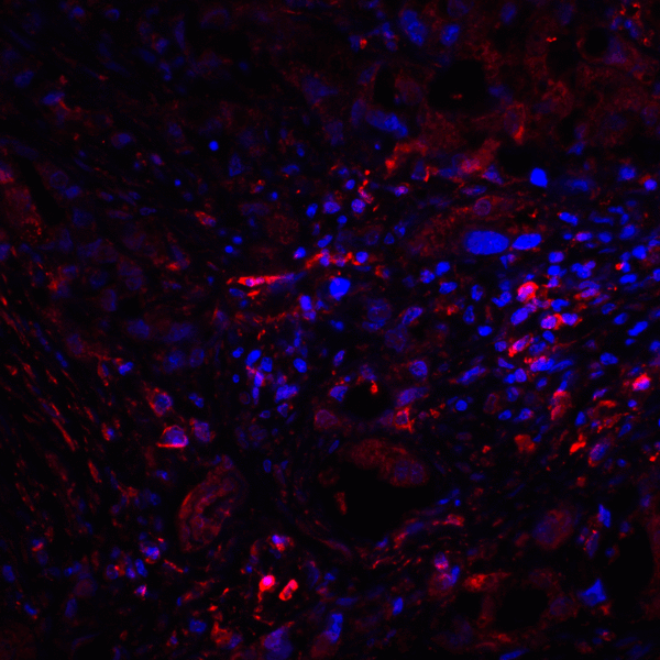 CTLA4 / CD152 Antibody - Immunofluorescence of CTLA-4 in human lymph node tissue with CTLA-4 antibody at 20 ug/mL. Red: CTLA4 Antibody [2G10] Blue: DAPI staining