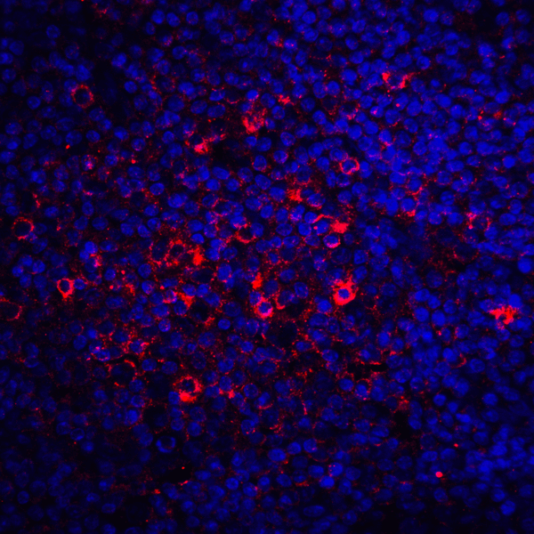 CTLA4 / CD152 Antibody - Immunofluorescence of CTLA-4 in human tonsil tissue with CTLA-4 antibody at 20 ug/mL. Red: CTLA4 Antibody [2G10] Blue: DAPI staining