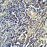 CTLA4 / CD152 Antibody - Immunohistochemistry of CTLA-4 in human tonsil tissue with CTLA-4 antibody at 5 ug/mL.