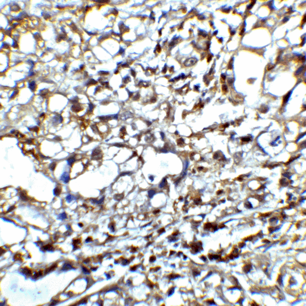 CTLA4 / CD152 Antibody - Immunohistochemistry of CTLA-4 in human lymph node tissue with CTLA-4 antibody at 5 ug/mL.