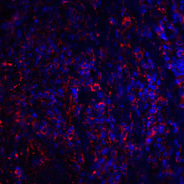 CTLA4 / CD152 Antibody - Immunofluorescence of CTLA-4 in human tonsil tissue with CTLA-4 antibody at 20 ug/mL. Red: CTLA4 Antibody [8A1] Blue: DAPI staining