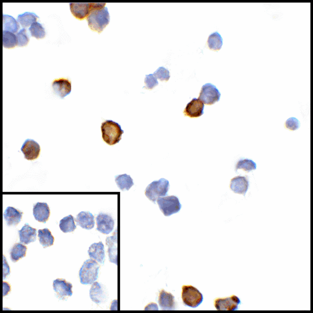 CTLA4 / CD152 Antibody - Immunocytochemistry of CTLA-4 in transfected HEK293 cells with CTLA-4 antibody at 5 ug/mL. Lower left: Immunocytochemistry in transfected HEK293 cells with control mouse IgG antibody at 5 ug/mL.