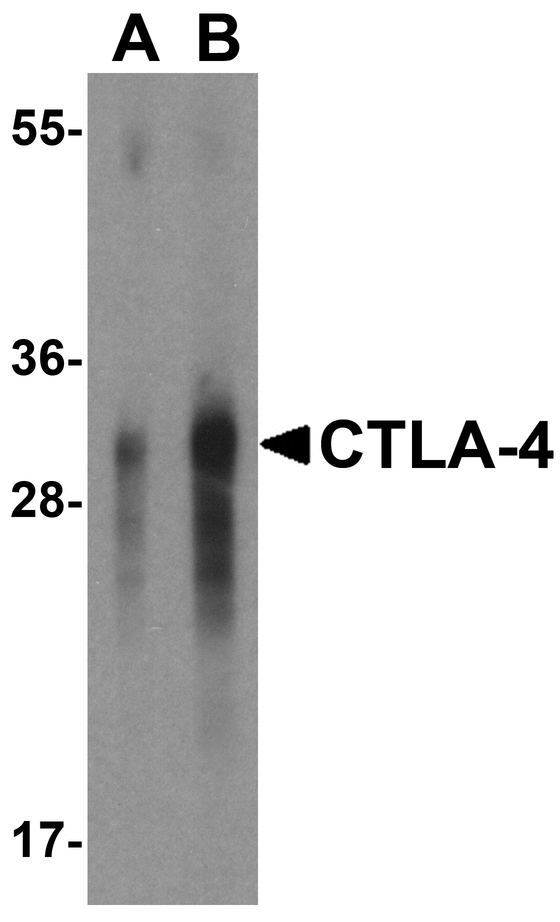 CTLA4 / CD152 Antibody - Western blot analysis of CTLA-4 in overexpressing HEK293 cells CTLA-4 antibody at 0.5 and 1 ug/mL.