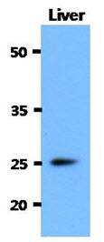 CTLA4 / CD152 Antibody - Western Blot: The extract of Mouse Liver (40 ug) were resolved by SDS-PAGE, transferred to PVDF membrane and probed with anti-human CTLA4 antibody (1:3000). Proteins were visualized using a goat anti-mouse secondary antibody conjugated to HRP and an ECL detection system.