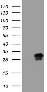 CTLA4 / CD152 Antibody - HEK293T cells were transfected with the pCMV6-ENTRY control (Left lane) or pCMV6-ENTRY CTLA4 (Right lane) cDNA for 48 hrs and lysed. Equivalent amounts of cell lysates (5 ug per lane) were separated by SDS-PAGE and immunoblotted with anti-CTLA4 (1:2000).