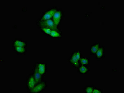 CTLA4 / CD152 Antibody - Immunofluorescent analysis of HepG2 cells at a dilution of 1:100 and Alexa Fluor 488-congugated AffiniPure Goat Anti-Rabbit IgG(H+L)