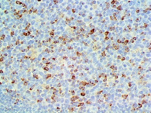 CTLA4 / CD152 Antibody - IHC of CTLA-4 / CD152 on an FFPE Tonsil Tissue